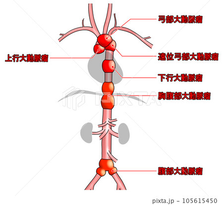 首から腰までのシンプルな大動脈概略図 105615450
