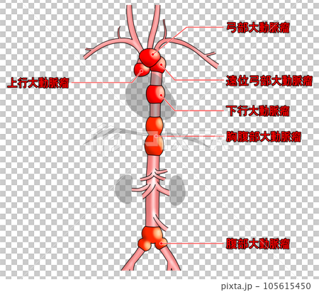 首から腰までのシンプルな大動脈概略図 105615450