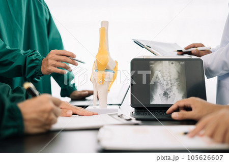 serious doctors team are analyzing fracture knee model showing the process of osteoarthritis patients and knee arthroplasty. serious doctors team are analyzing fracture knee model showing the process of osteoarthritis patients and knee arthroplasty. 105626607