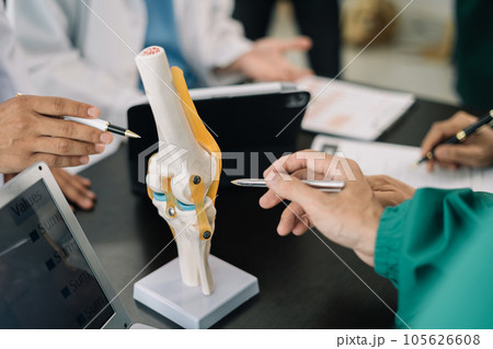 serious doctors team are analyzing fracture knee model showing the process of osteoarthritis patients and knee arthroplasty. 105626608