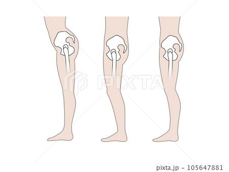 シンプル腰回り(横から)骨盤後傾 骨盤前傾 猫背 腰痛 シンプル腰回り(横から)骨盤後傾 骨盤前傾 猫背 腰痛 105647881