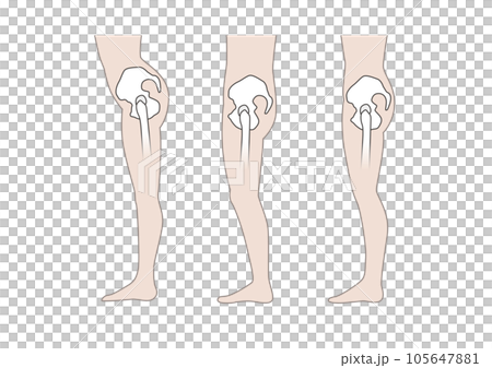 シンプル腰回り(横から)骨盤後傾 骨盤前傾 猫背 腰痛 シンプル腰回り(横から)骨盤後傾 骨盤前傾 猫背 腰痛 105647881