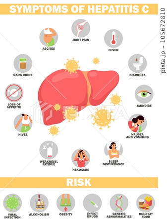 Symptom and risk of hepatitis vector illustration Symptom and risk of hepatitis vector illustration 105672810
