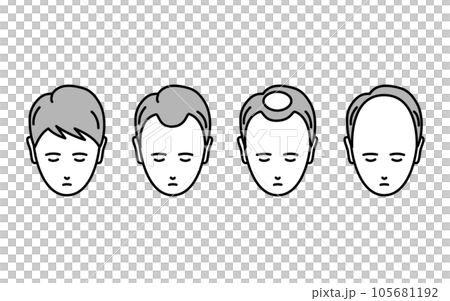 AGA、脱毛症が進行する男性のイラスト AGA、脱毛症が進行する男性のイラスト 105681192