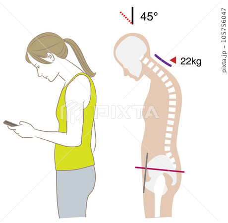 スマートフォンを見る首の角度と負荷、傾き45度 スマートフォンを見る首の角度と負荷、傾き45度 105756047