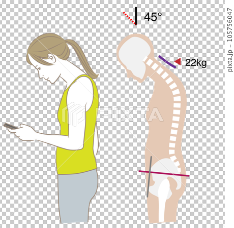 スマートフォンを見る首の角度と負荷、傾き45度 スマートフォンを見る首の角度と負荷、傾き45度 105756047