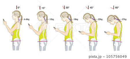首の傾く角度と負荷、猫背と骨盤後傾の骨格図 首の傾く角度と負荷、猫背と骨盤後傾の骨格図 105756049