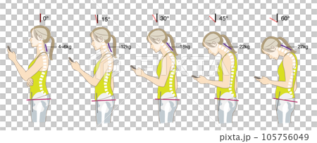 首の傾く角度と負荷、猫背と骨盤後傾の骨格図 首の傾く角度と負荷、猫背と骨盤後傾の骨格図 105756049