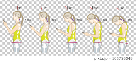 首の傾く角度と負荷、猫背と骨盤後傾の骨格図 105756049