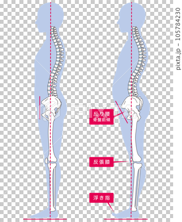 Curvature waist posture comparison 105784230