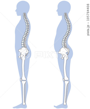 反り腰の姿勢　比較 105784408