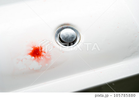 Blood clot in the sink. Problem with gums 105785880