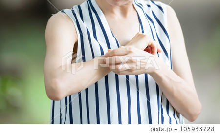 虫刺され　痒み　女性 105933728