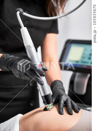 Close up of cosmetologist hands using radiofrequency microneedling device while removing stretch marks on female buttocks. Woman having skin tightening procedure in beauty clinic. Close up of cosmetologist hands using radiofrequency microneedling device while removing stretch marks on female buttocks. Woman having skin tightening procedure in beauty clinic. 105935670