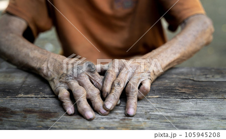 Elderly man holding hands on knees because of disease, health care or elderly concept. Elderly man holding hands on knees because of disease, health care or elderly concept. 105945208