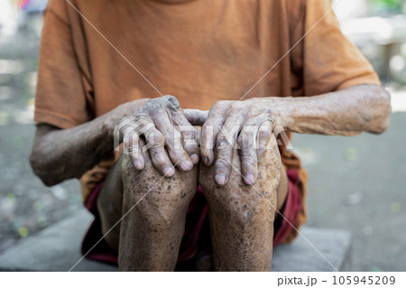 Elderly man holding hands on knees because of disease, health care or elderly concept. Elderly man holding hands on knees because of disease, health care or elderly concept. 105945209