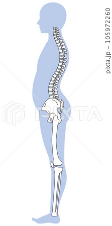 反り腰の姿勢　骨盤の傾き 105972260