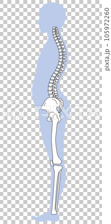 反り腰の姿勢　骨盤の傾き 105972260