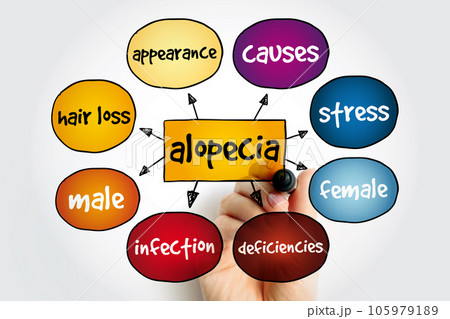 Alopecia mind map, medical concept for presentations and reports 105979189