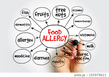 Food allergy mind map, health concept for presentations and reports 105979621
