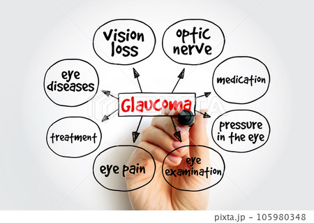 Glaucoma is a group of eye diseases that result in damage to the optic nerve (or retina) and cause vision loss, mind map medical concept background 105980348
