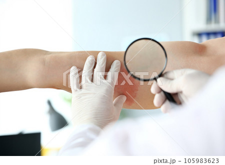 Gloved hands of professional doctor 105983623