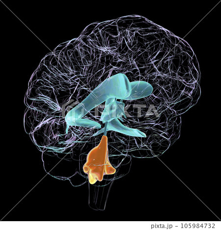 Enlarged fourth ventricle of the brain, 3D illustration 105984732