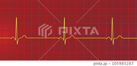 Electrocardiogram ECG displaying sinus bradycardia, 3D illustration Electrocardiogram ECG displaying sinus bradycardia, 3D illustration 105985287