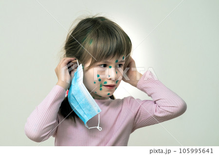 Child girl wearing blue protective medical mask ill with chickenpox, measles or rubella virus with rashes on body. Children protection during epidemic of coronovirus. Covid-19 contagion concept. 105995641