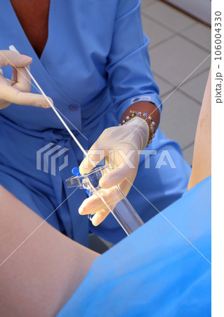 Pipelle biopsy procedure. The gynecologist performs a pipelle biopsy. Gynecological chair. A woman at the gynecologist for a check-up. 106004330