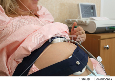 A fetal cardiac monitoring device for pregnant women. Pregnancy cardiac monitoring. STV test. Fetal cardiac monitor in pregnant women. Fetal cardiography. 106005983