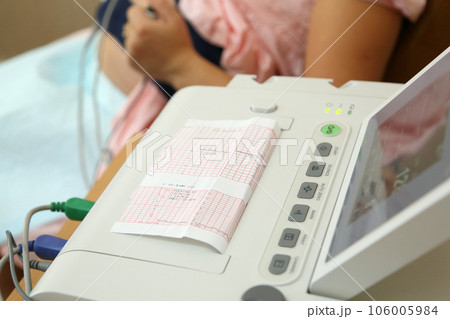 A fetal cardiac monitoring device for pregnant women. Pregnancy cardiac monitoring. STV test. Fetal cardiac monitor in pregnant women. Fetal cardiography. A fetal cardiac monitoring device for pregnant women. Pregnancy cardiac monitoring. STV test. Fetal cardiac monitor in pregnant women. Fetal cardiography. 106005984