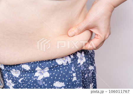 【わき腹の肉を摘む主婦】 106011767