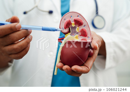 Chronic kidney disease, doctor holding model for treatment urinary system, urology, Estimated glomerular filtration rate eGFR. Chronic kidney disease, doctor holding model for treatment urinary system, urology, Estimated glomerular filtration rate eGFR. 106021244