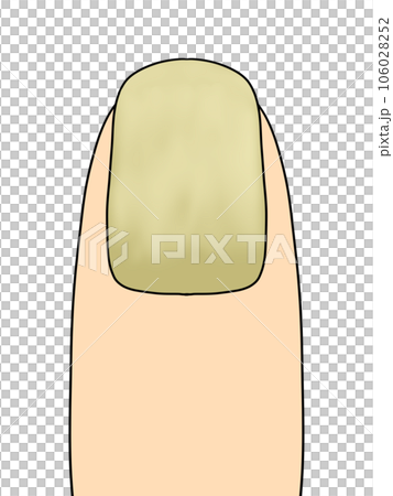 fingernails (yellow) fingernails (yellow) 106028252