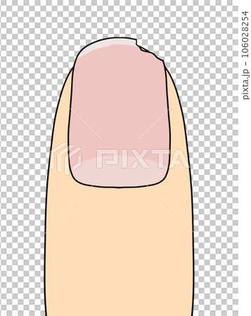 fingernails (missing) 106028254