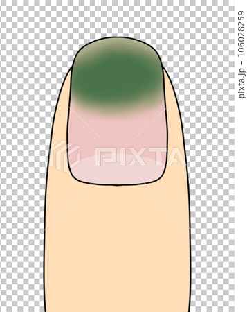 fingernails (green) 106028259