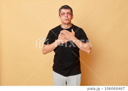 Unhealthy unhappy man in black T-shirt with bruises and abrasions on his face isolated over beige background feeling strong pain chest after car accident. Unhealthy unhappy man in black T-shirt with bruises and abrasions on his face isolated over beige background feeling strong pain chest after car accident. 106068467