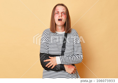 Shockedinjuredwoman with bandage has problems with health felling strong pain in arm after car accident has bruised skin standing isolated over beige background Shockedinjuredwoman with bandage has problems with health felling strong pain in arm after car accident has bruised skin standing isolated over beige background 106073933
