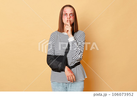 Scared sick woman with scratches and bruises on her face standing isolated over beige background keeps finger near mouth asking not to tell about violence. Scared sick woman with scratches and bruises on her face standing isolated over beige background keeps finger near mouth asking not to tell about violence. 106073952
