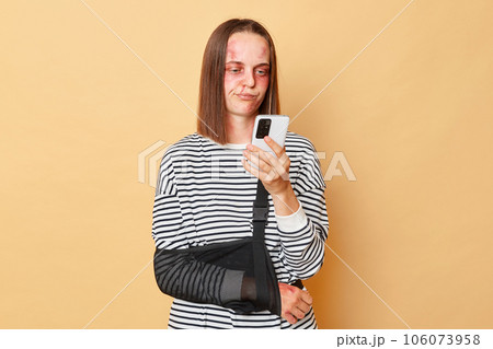 Disappointedinjuredwoman with bruise on face wearing bandage using mobile phone isolated over beige background browsing internet needs psychological help after violence. Disappointedinjuredwoman with bruise on face wearing bandage using mobile phone isolated over beige background browsing internet needs psychological help after violence. 106073958