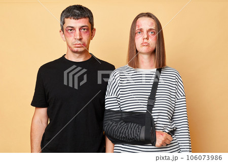 Sad upset man and woman with bruise isolated over beige background suffering after car accident female broken arm standing with bandage having traumas feeling pain. 106073986