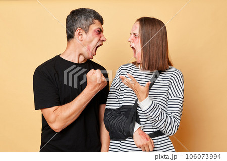 Family conflict. Home violence. Arguing couple. Angry  man and woman with bruise isolated over beige background screaming having quarrel and fighting, having body trauma. 106073994