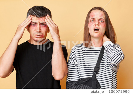 Unhealthy man and woman with bruise isolated over beige background feeling pain after accident, beating, looking at camera with sick look. Unhealthy man and woman with bruise isolated over beige background feeling pain after accident, beating, looking at camera with sick look. 106073996
