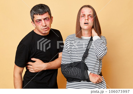 Unhealthy man and woman with bruise isolated over beige background couple injured from the attack of criminals, body injuries, severe pain, bodily bruises 106073997