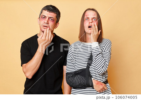 Despair man and woman with bruise isolated over beige background couple injured in car accident have traumas rehabilitation after bodily injuries 106074005