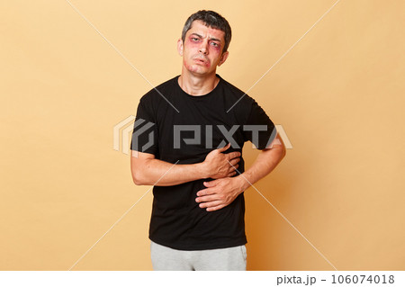 Unhappy injured man in black T-shirt with bruises and abrasions on his face isolated over beige background falling down from stairs having trauma feeling strong pain. 106074018