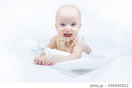 a baby with a hemangioma on his neck lies on a white background a baby with a hemangioma on his neck lies on a white background 106090822