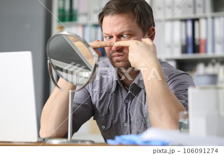 Portrait of middle-aged man sitting opposite small table mirror and squeezing acne problems Portrait of middle-aged man sitting opposite small table mirror and squeezing acne problems 106091274