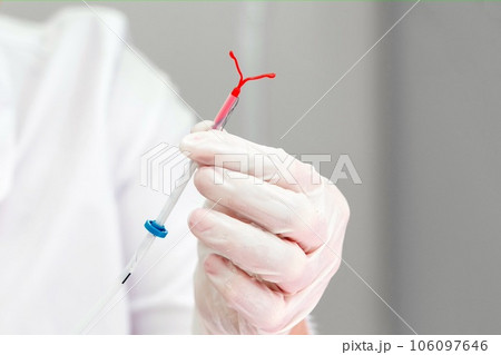 Gynecologist holding an IUD birth control device 106097646